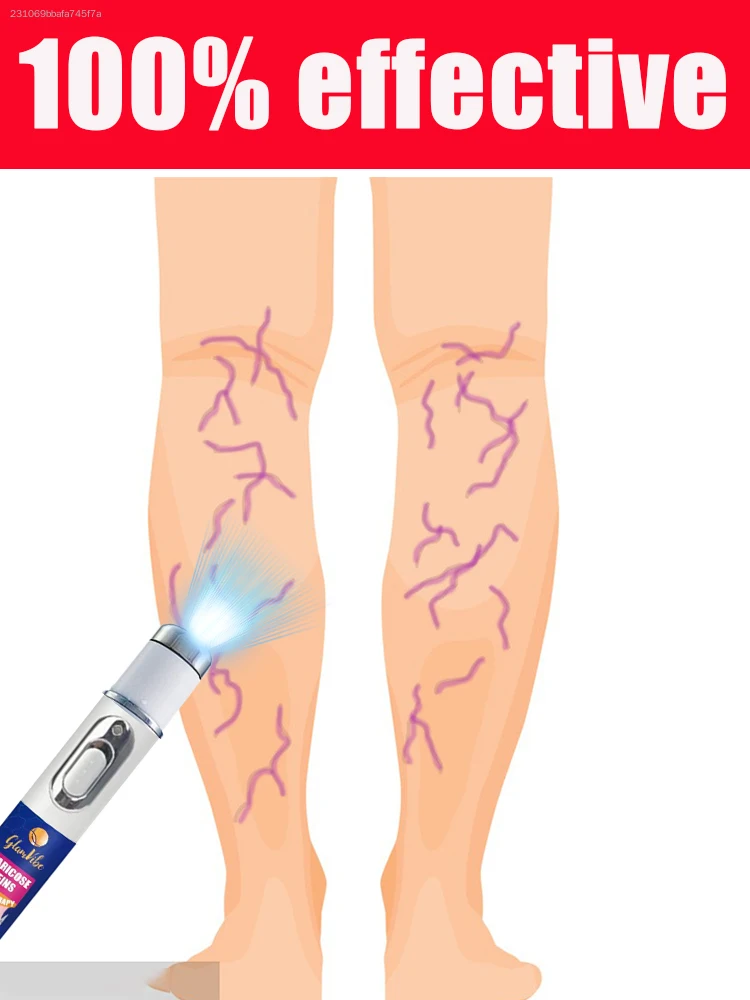 

Make your legs beautiful without leaving scars