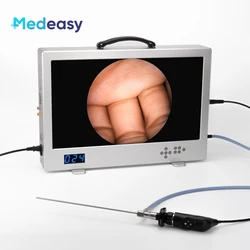 Medical Full HD Endoscope Camera System with 24 Inch Monitor, 80W Led Light Source and Record Function