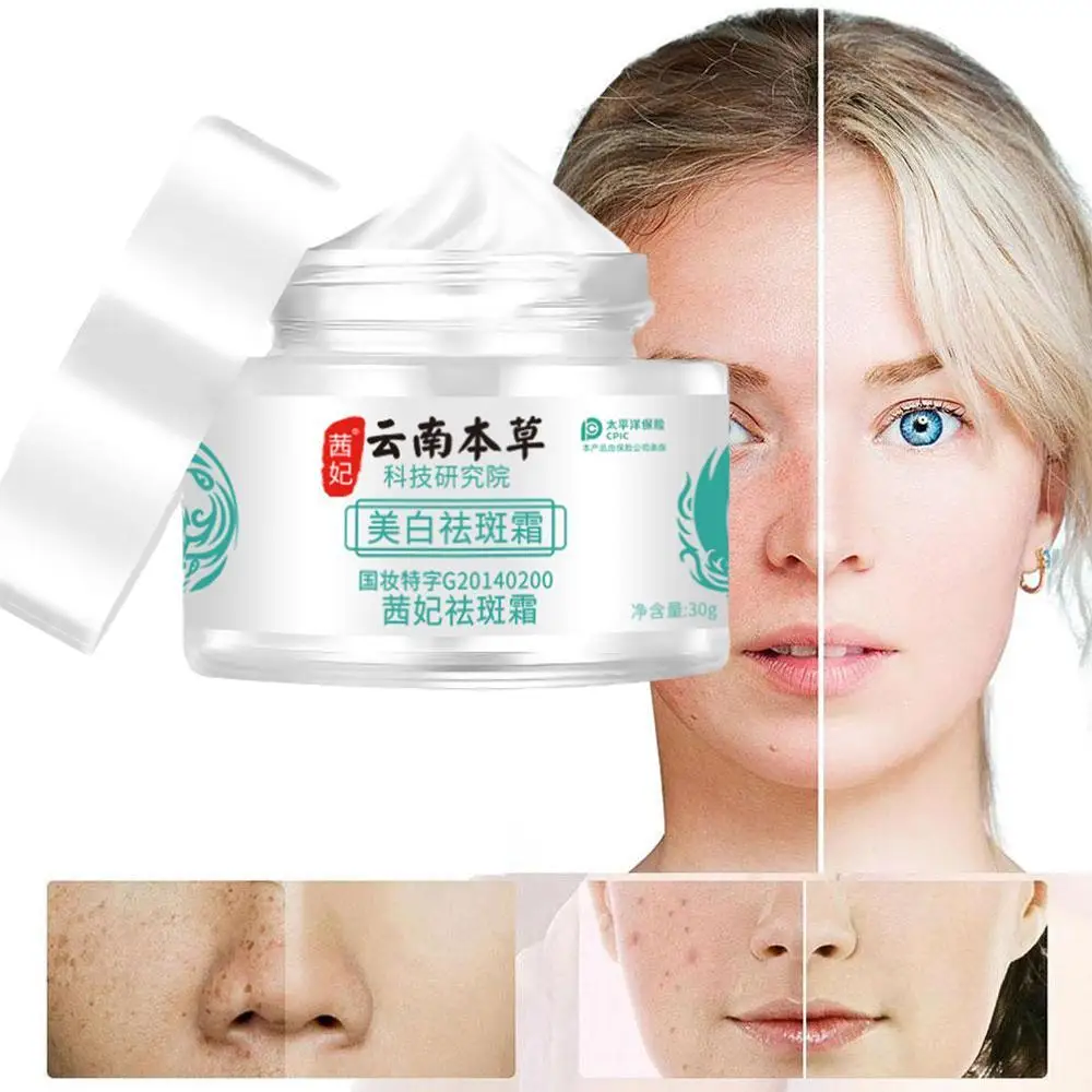 

20g Herb Powerful Whitening Freckle Cream Remove Acne Spots Dark Spots Face Moisturizing Face Skin Care Beauty Yun Nan