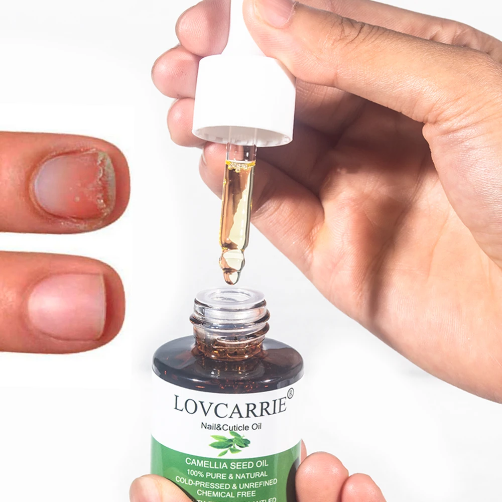 Lovcarrie Cuticula Olie Voor Nagels Kunstbehandeling 20Ml Voedingsformule Proteïne Nagel Reparatie Etherische Olie Serum Voedingshulpmiddelen