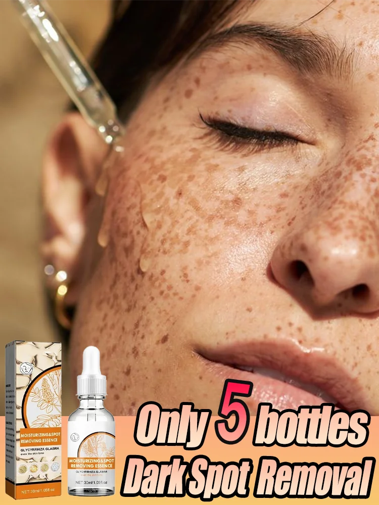 Anti-Freckles Whitening Lightening Serum Age Spots Chloasma Hydration Beautifying Moisturizing Facial Essence