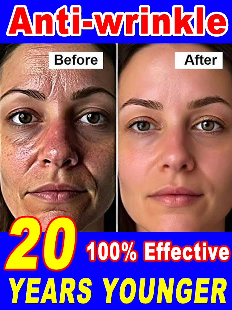 

wrinkles disappear become beautiful now
