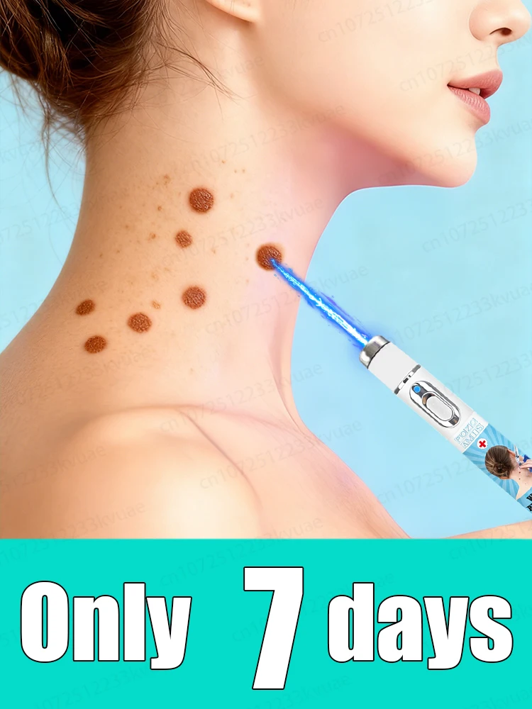 

Недавно обновленная версия, рассказывающая прощайте на хородавки за 7-днем.