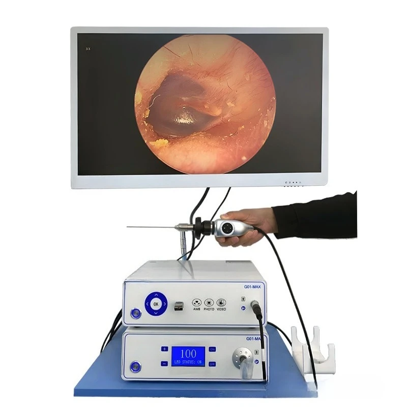 G01MAX high definition 1080P dual host visual ear picking equipment, professional ear picking instrument freeze