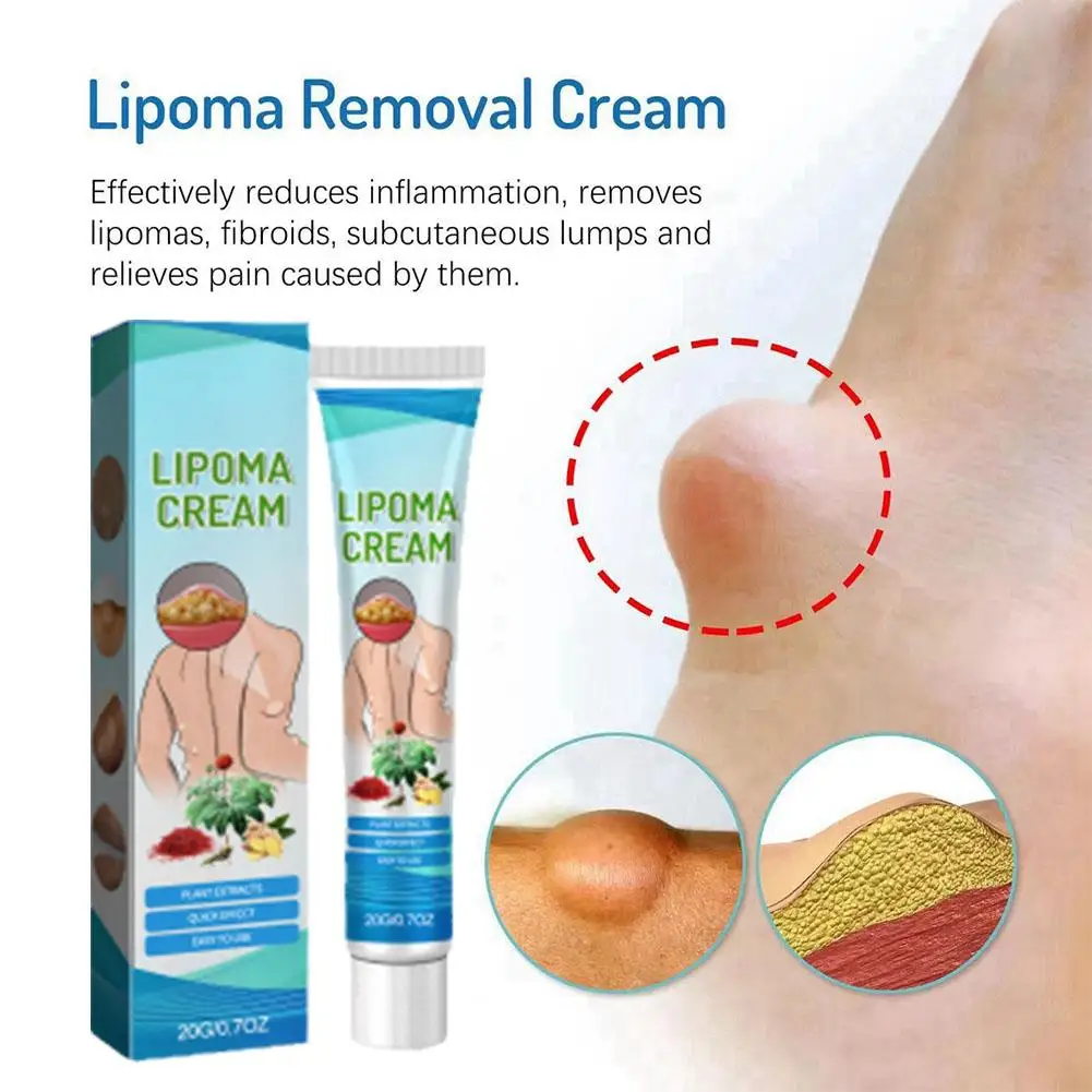 20g Lipoma Cream For Helath Degreasing Cream For Men And Women