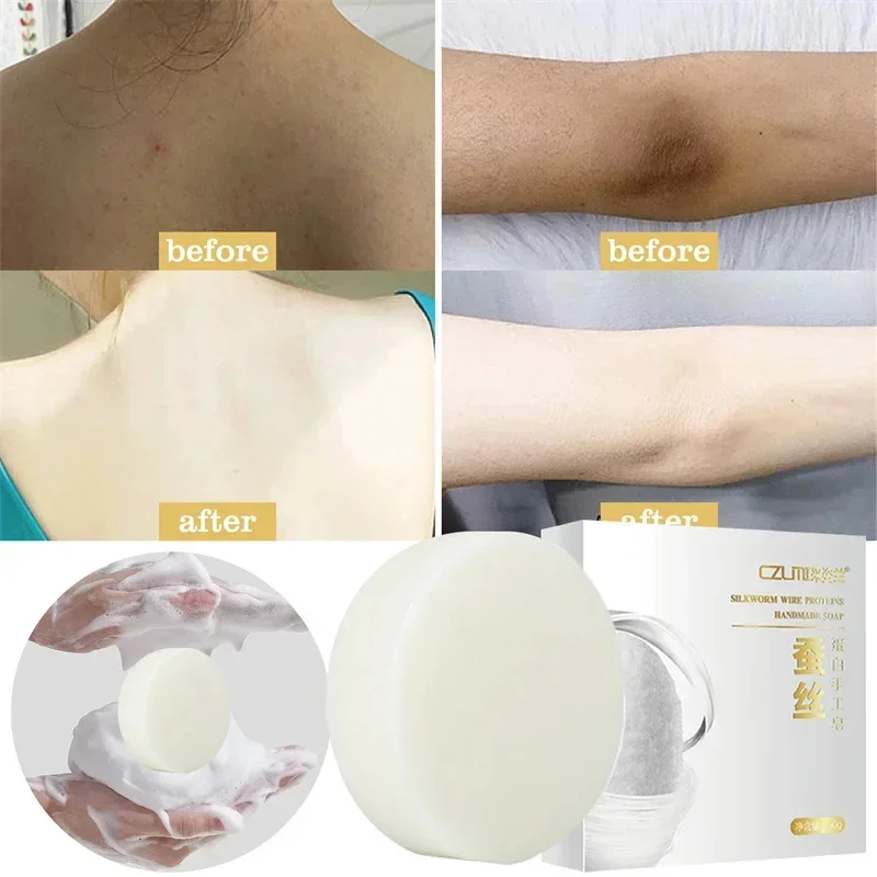 

Body Whitening Soap Underarm Knee Bleaching Soap Chicken Skin Removal Dark Spot Removal Dead Skin Moisturize Brighten Body Care