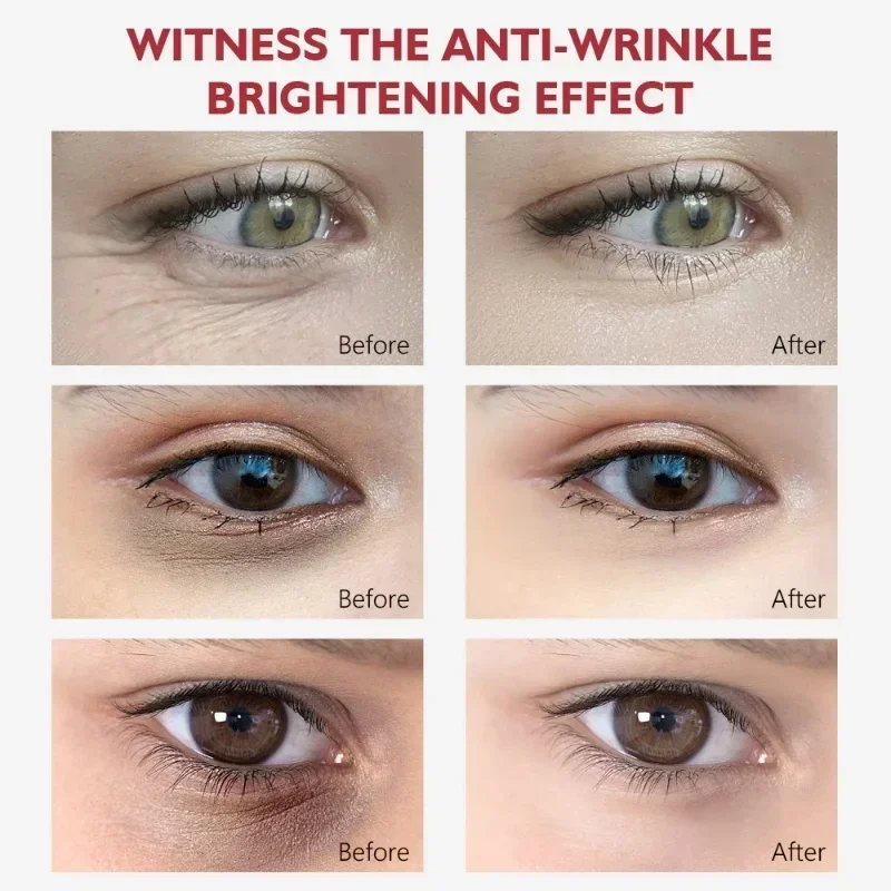 2024 Nicotinamide Eyes Cream Dark Circles Fading Eye Bags Eye Hyaluronic Acid Moisturizing Serum Against Puffiness Eye Care Gel