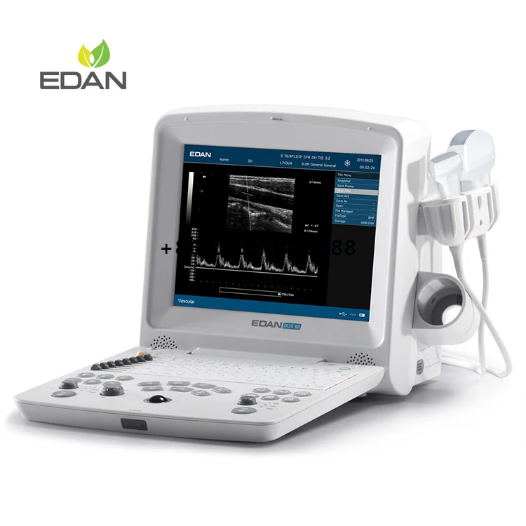 Edan-DUS-60 Portable Medical Ultrasonido Sonografo Portatil Ecografo Edan-DUS-60 Ultrasound Machine