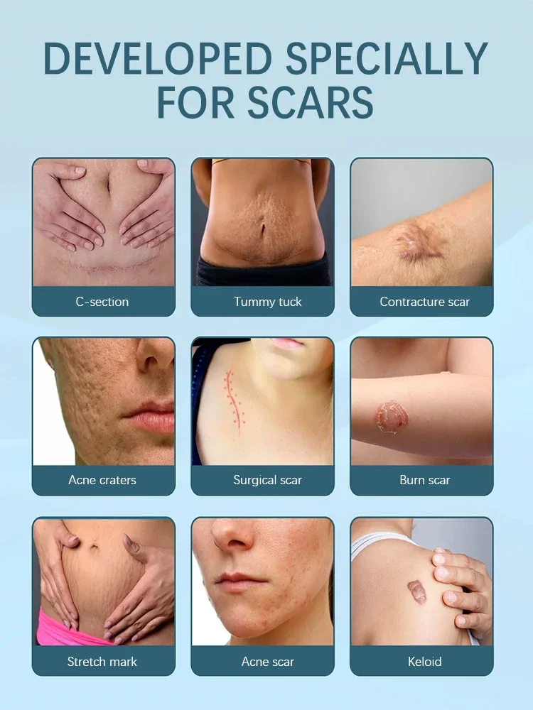 Repair scars and bring skin back to life