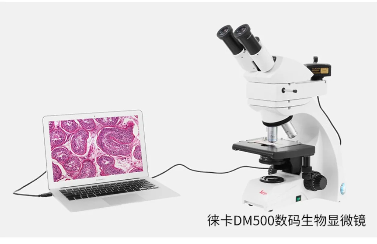 Microscope camera industrial CCD fluorescence photography video measurement phase analysis pathological report high definition