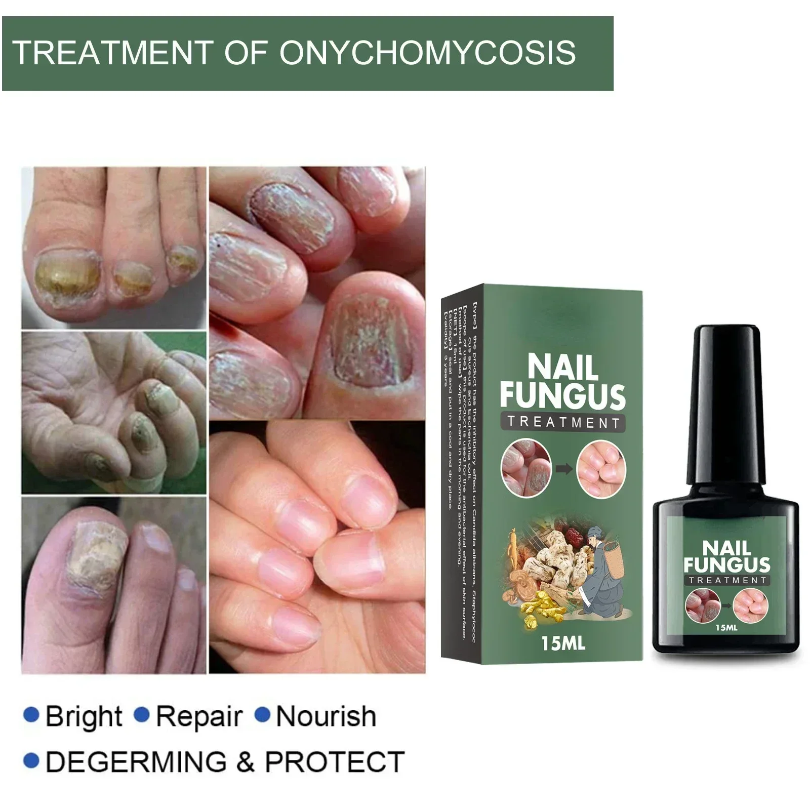 Nail Fungal Treatment Essence Oil Foot Toe Nail Fungus Removal Serum 7 Days Repair Onychomycosi Anti Infection Gel Care Products