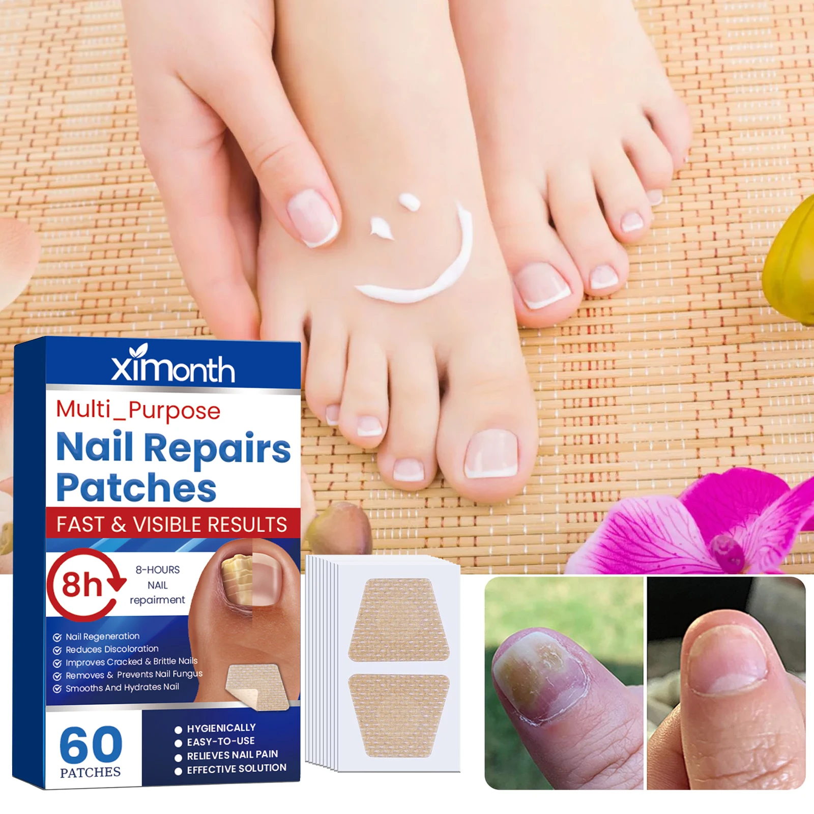 Nail Ingrown Correction Toenail Fungus Patch Stickers Sticky Plant Extract Painless Nails Care Recover Pedicure Nail Care 60pcs