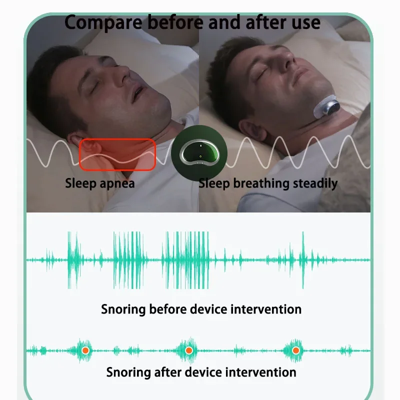 Nuevo YA4300 antironquidos inteligente, intervención de Apnea inteligente, pulso de frecuencia media y baja, antironquidos para el hogar