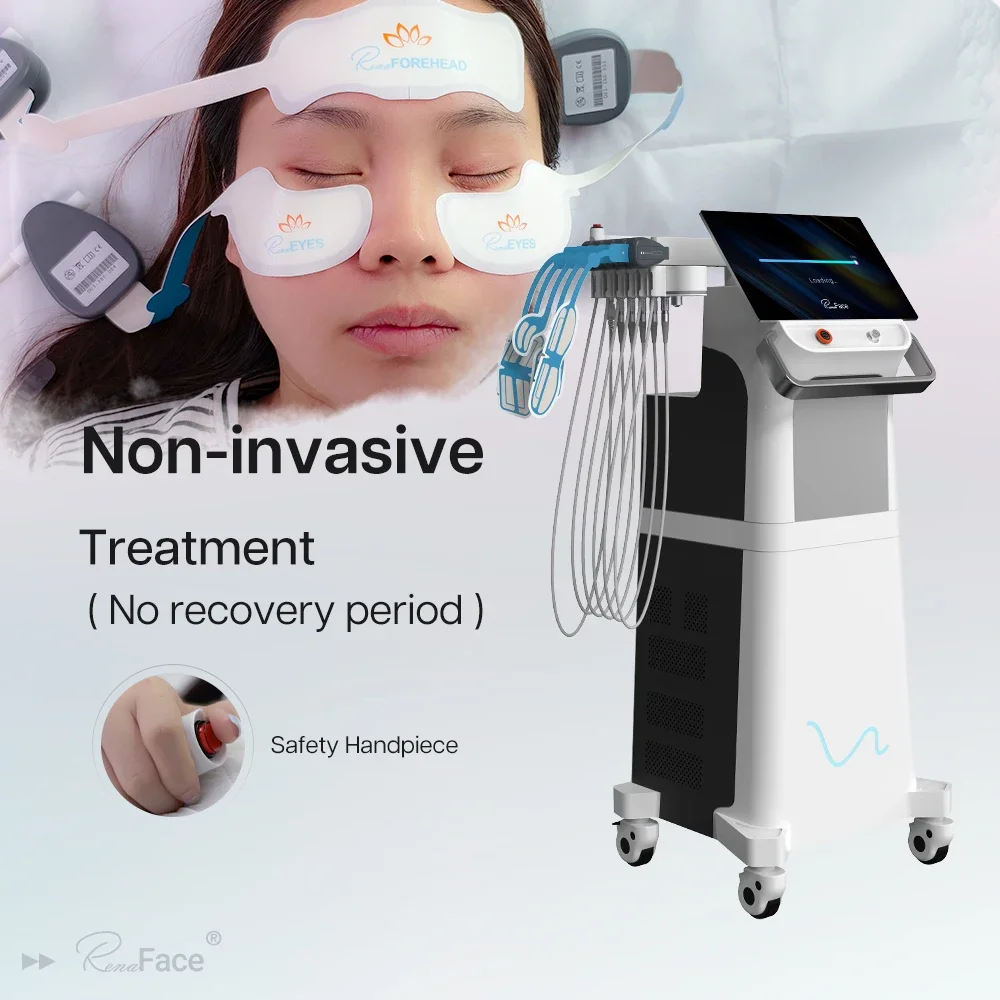 Renaface Non-Invasive Rf Face Lifting Neck Wrinkle Removal  Machine With 5 Channels