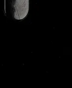 1Pc Hearing Aid Clip Clamp Rope Holder Protector Falling Losing Storage Case Box