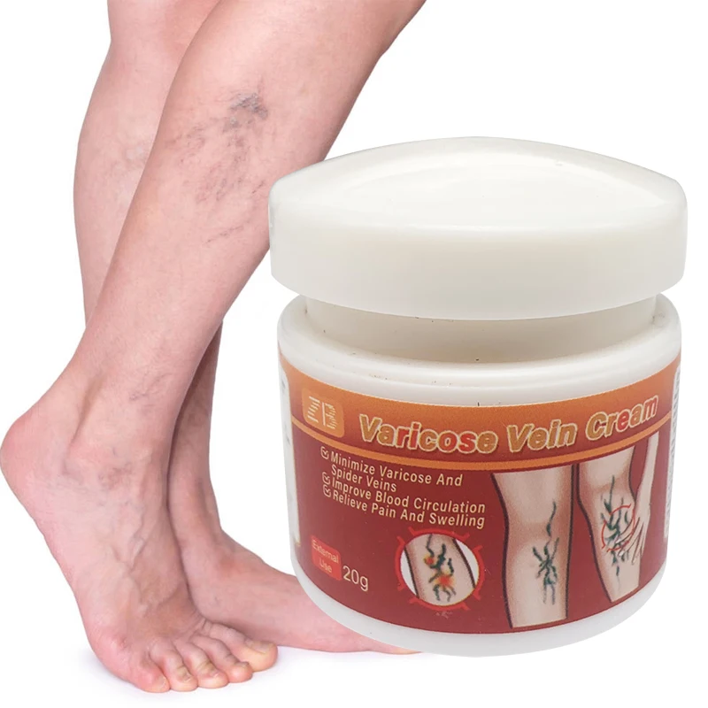 20g Varicose Veins Ointment Relief Pain Cream For Vasculitis Phlebitis Angiitis Tube  Relief Earthworms Leg Cream Skin Care