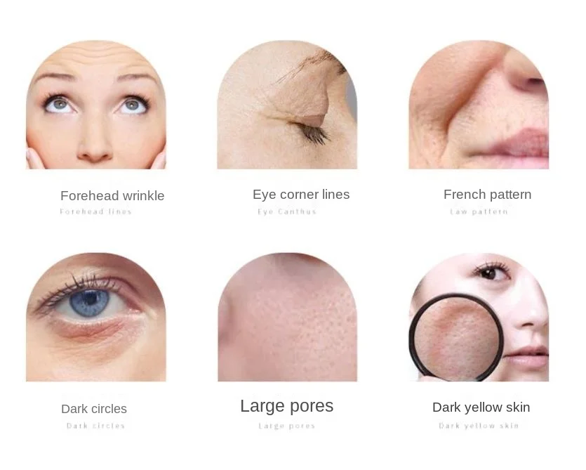 Urządzenie kosmetyczne 6 w 1: plazma, termiczna maszyna do bąbelków, hydrofacial wodorowo-tlenowy, jonowy młotek zimny, RF, bipolarny polimer-woda