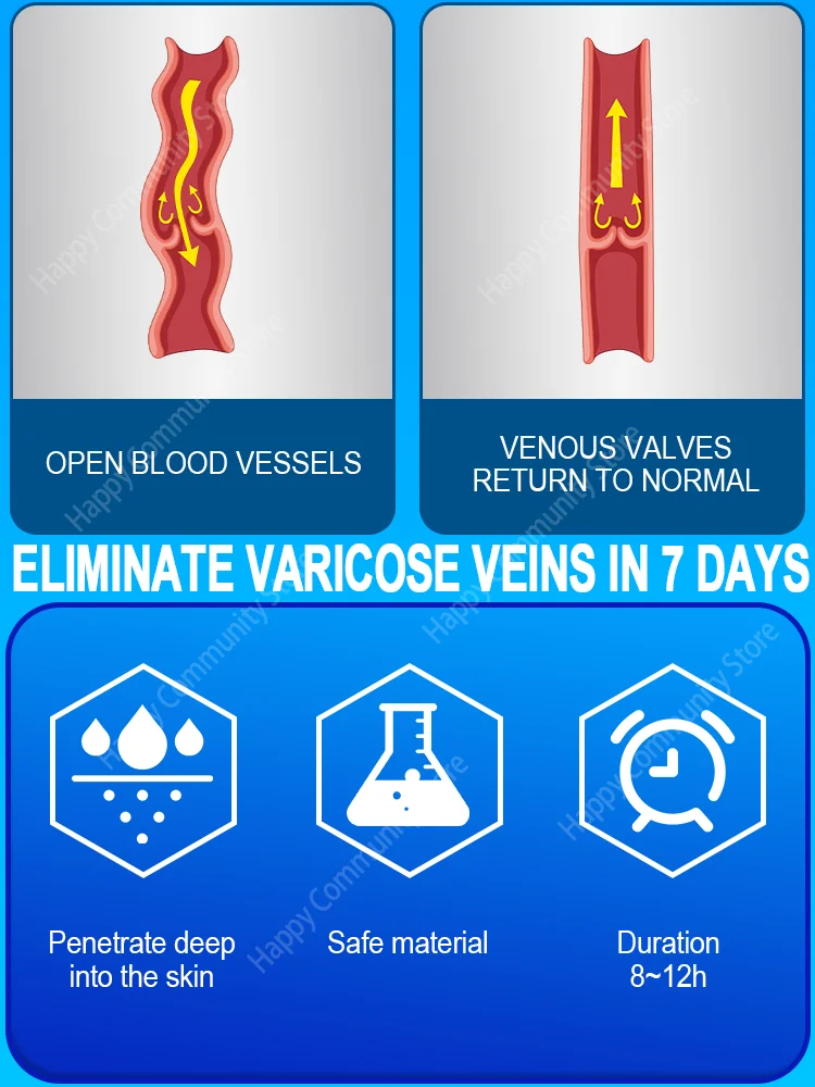 Veinespoder osa terapia ein laser para varis iert modera das, alivia a dor e melhora a circulaçaFore o para homens e mulheres