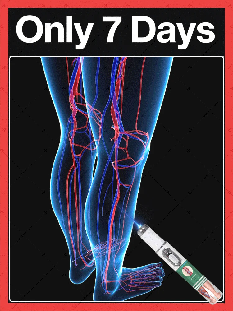 

blue light pen solve varicose veins,2025 NEW hot sale leg care tools