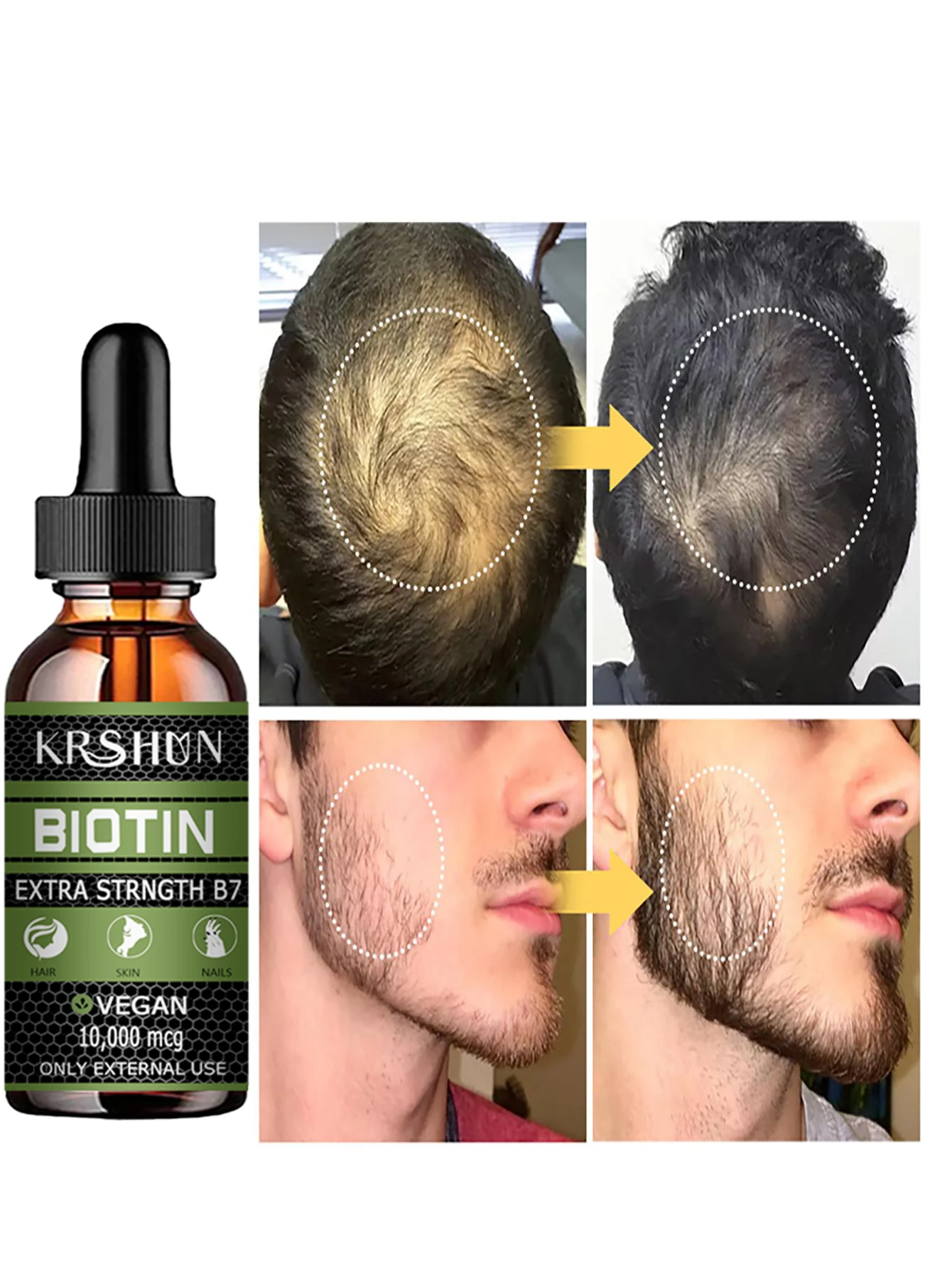 2022 Biotin Fast Hair Growth Oil Hair Regrowth Serum Hair Thinning Treatment Hair Growth Liquid Anti-Hair Loss for Women & Men