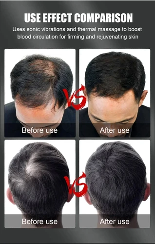 Imagen 2 del producto Nuevo 96 Uds LED infrarrojos 660nm y 850nm terapia de luz roja gorro de crecimiento del cabello para el crecimiento del cabello Anti pérdida de cabello relajar el cuero cabelludo sombrero para el cuidado del cabello