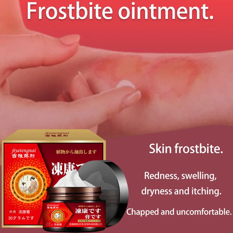 Jiyato Yuezikang Cream 30g External Health Care Cream for Cracked Hands and Heels Care Frostbite Cream Manufacturer Wholesale