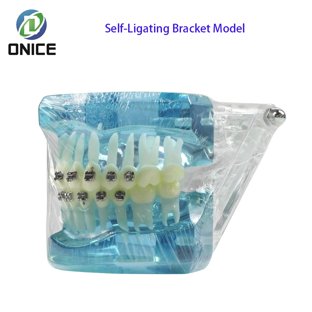 

Ceramic Lingual Self-Ligating Bracket M3012 - Blue Multi-Bracket Orthodontic Teaching Demo Kit