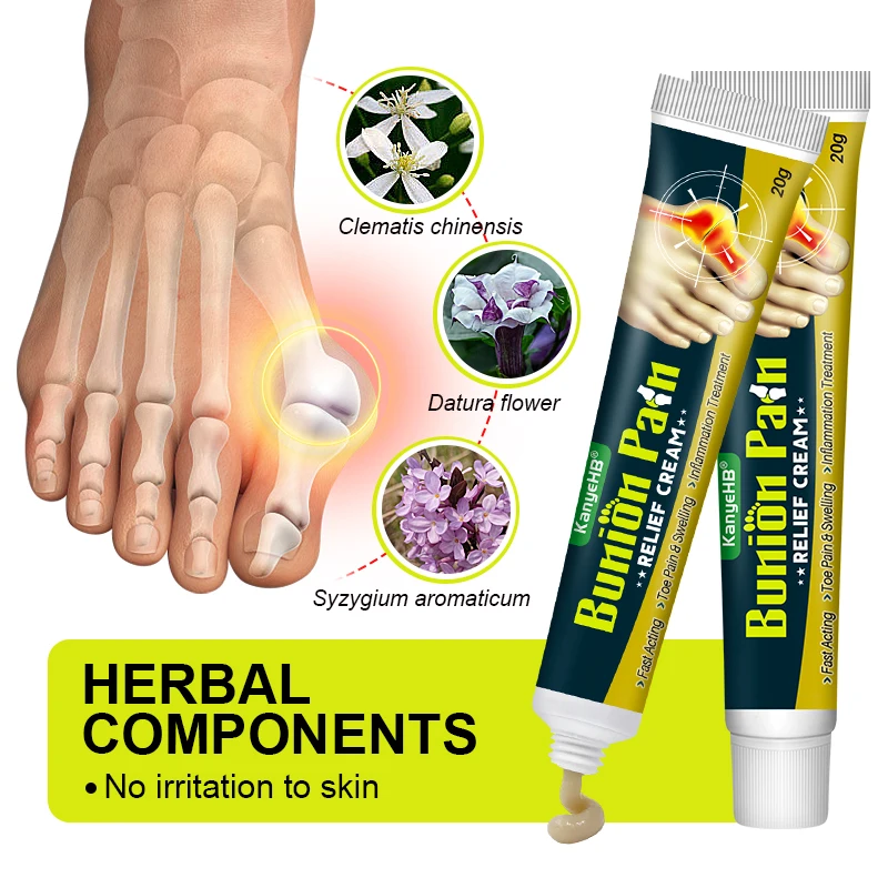 1Pcs Foot Gout Cream Arthritis Bone Thumb Corrector Finger Hallux Toe Bunion Joint Pain Relief Herbal Medical Care Ointment G049