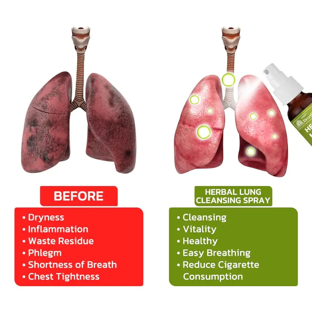 Spray de limpieza de pulmones a base de hierbas, desintoxicación de aliento, limpieza de pulmones a base de hierbas, limpieza de niebla de pulmones a base de hierbas, soporte de pulmones potente, 2 uds.