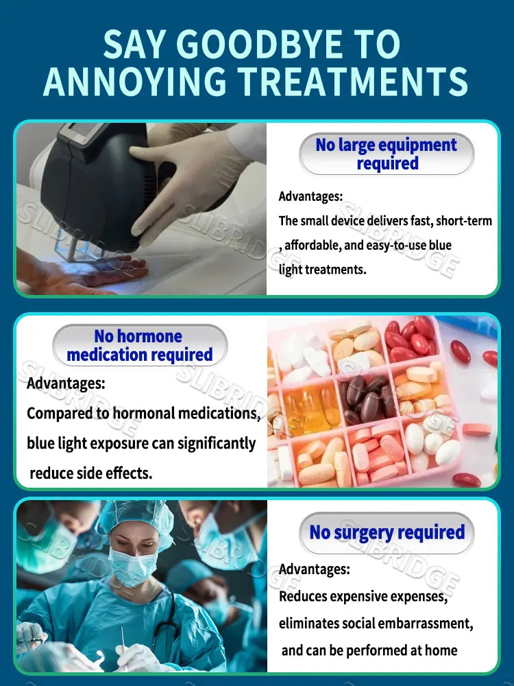 la penna a luce blu risolve il vitiligine, strumenti per la cura del vitiligine, unisex, vendita calda 2025