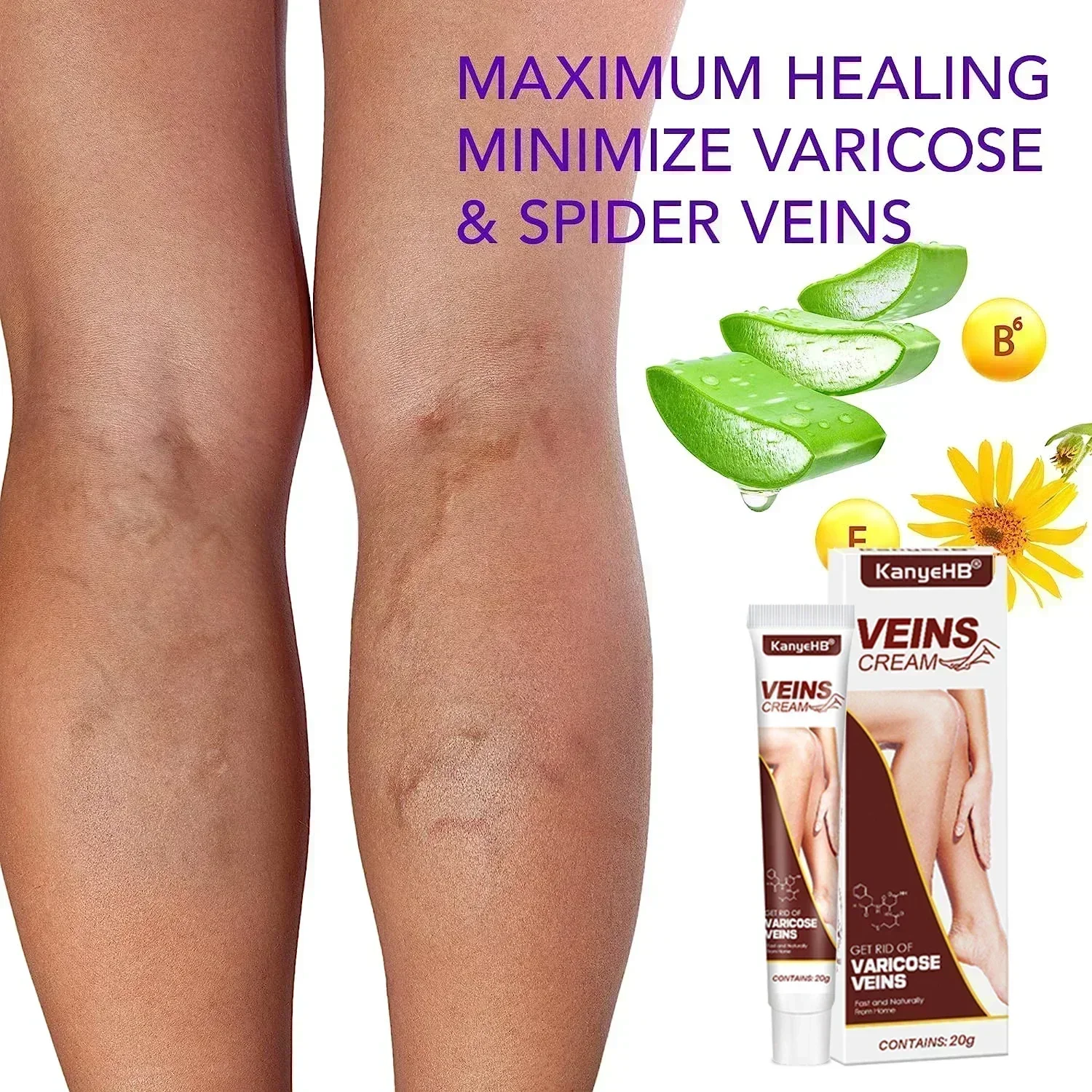 Eliminate Vasculitis Phlebitis Spider Legs Soothing Skin Care