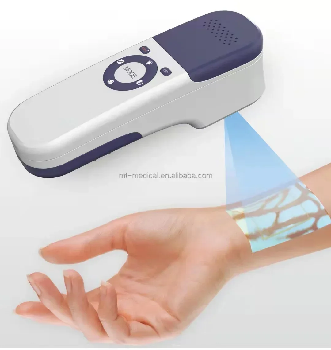 

MT MEDICAL Super Clear Мобильное устройство для поиска вен с изображением сосудистых проколов для больницы