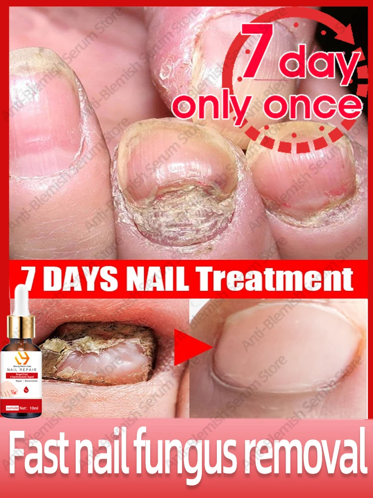 

Solve all nails problems