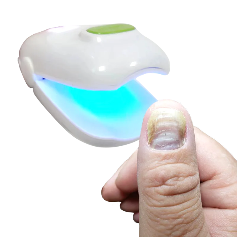 Nail fungus portable home treatment anti-fungal cold laser device Onychomycosis Clean Device for Fingernails and Toenail Fungus