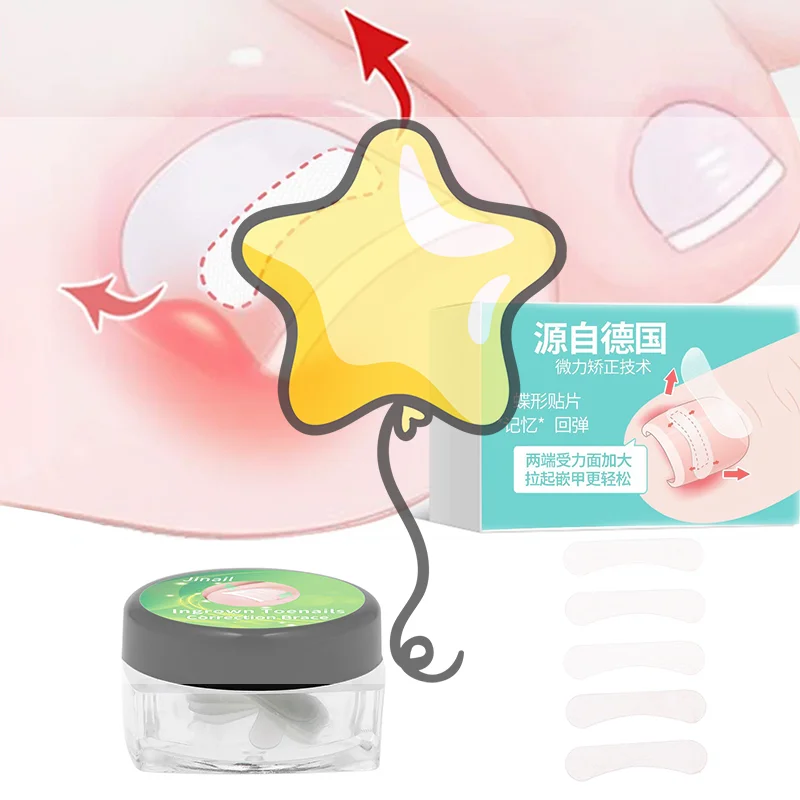 10Pcs Ingrown Toenail Correction Tool Straightening Clip Brace Ingrown Toe Nail Treatment Elastic Patch Sticker Pedicure Tool