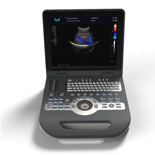 China Cheapest Price Medical Hospital Diagnosis Equipment Portable Laptop Ultrasound Scanner Machine for pregnancy