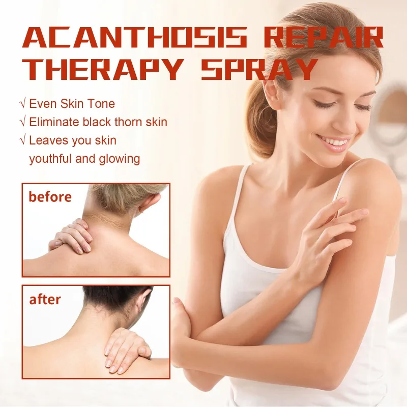 Acanthosis Nigricans Therapy Spray Remove Dark Melanin Armpit Elbow Knee Joint Whitening Clean Cuticle Peeling Body Remover