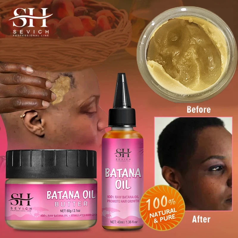 

100% Batana Hair Fast Growth Oil Set African Crazy Traction Alopecia Batana Hair Mask Anti Hair Break Hair Regrowth Treatment