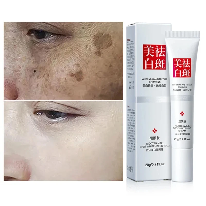 Crème blanchissante efficace pour le visage, éclaircit les taches, élimine les taches foncées Melasma, améliore la peau tactique, soin anti-pigmentation, nouveau, 2024