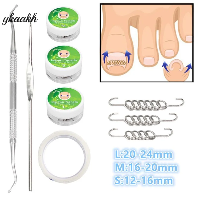 

Ingrown Toenail Corrector Tools Pedicure Recover Embed Toe Nail Treatment Professional Ingrown Toenail Correction Foot CareTool