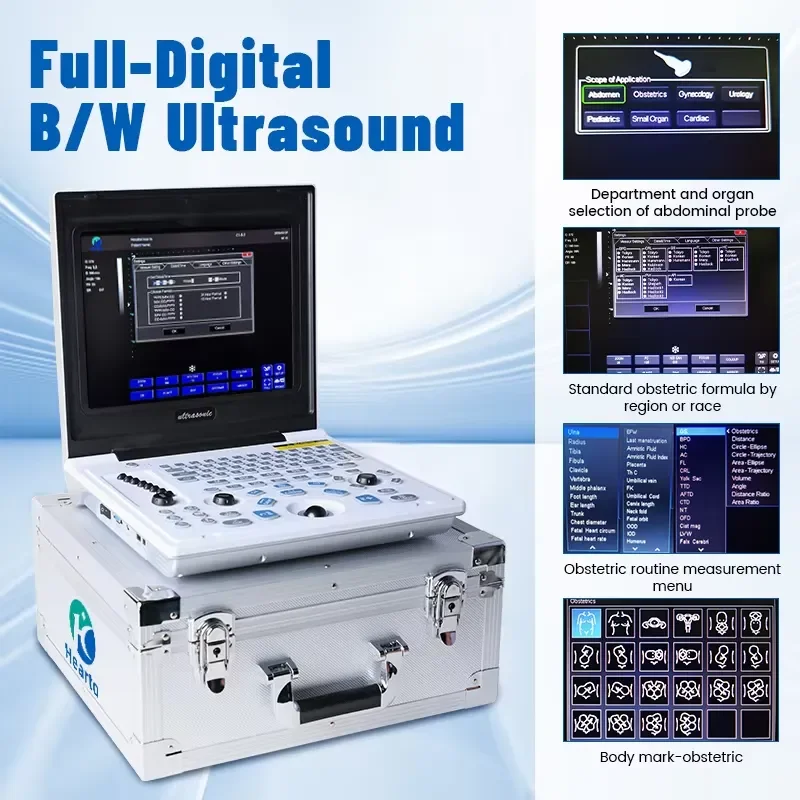 Portable Black and White Ultrasound Machine for Obstetrical Gynecological Abdominal Clinics Use