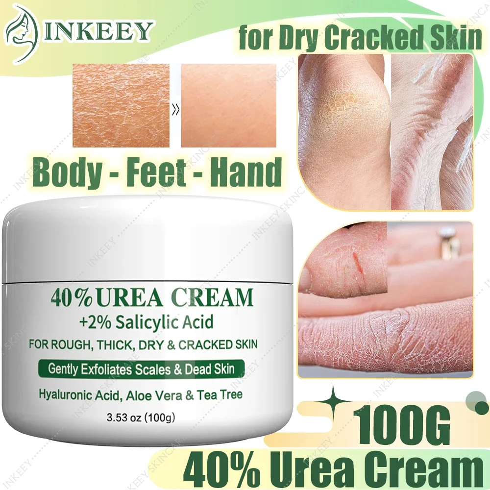 

Body Urea 40% Cream for Dry Cracked Feet Heels Hands Repairing Treatment Deeply Moisturizing Callus Dead Skin Remove Foot Care