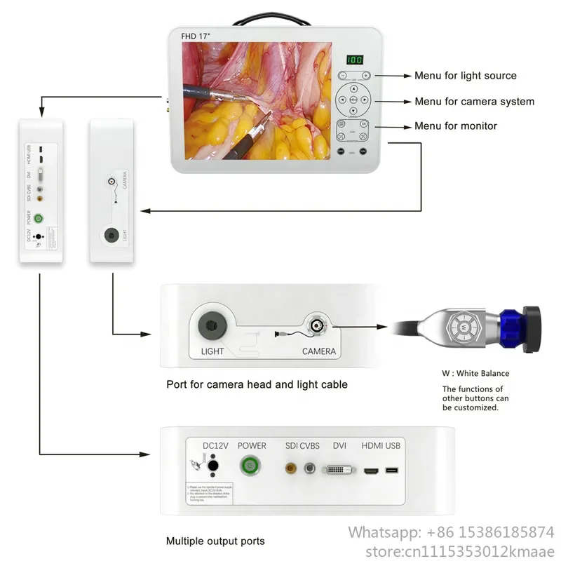 Rigid Endoscopy Camera System with 17 Inch All-in-One Monitor and Recording — ENT &