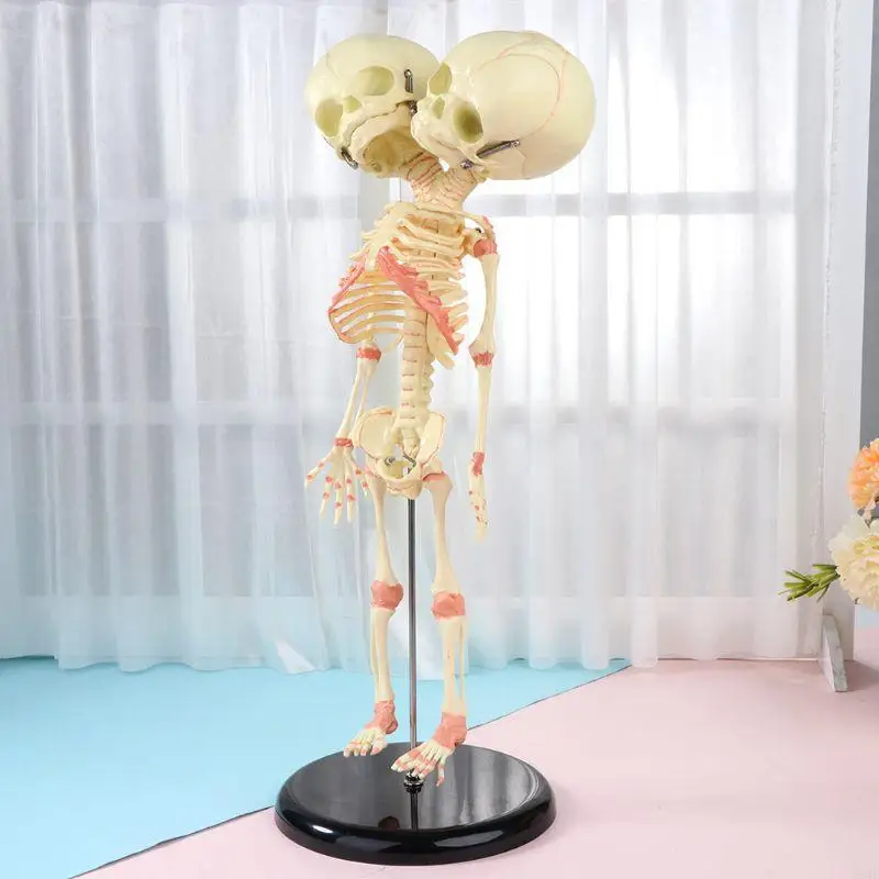 W89C 37 Human Double para Head Baby Skeleton Anatomy Anatomy Study Teach