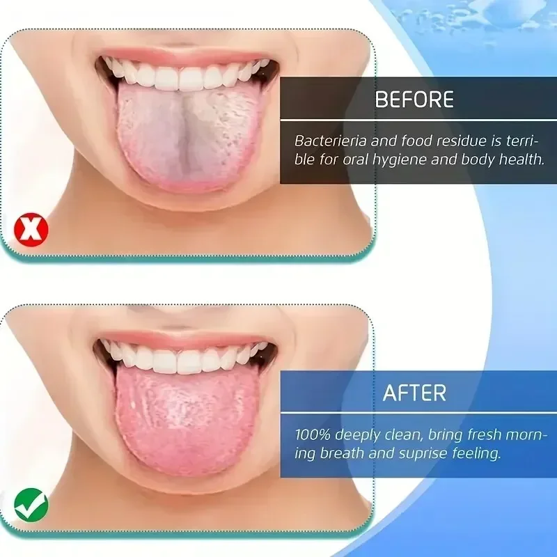Raschietto per lingua in acciaio inossidabile a 4 colori, metallo a forma di U, pulizia dell'alito fresco, spazzolino per lingua rivestito, strumenti per l'igiene orale