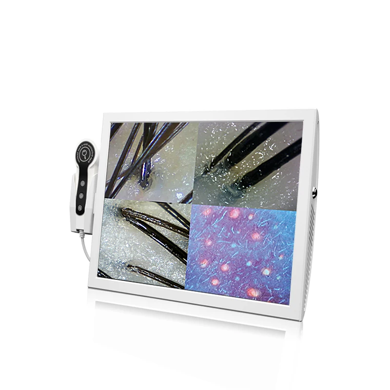 

OEM & ODM Высококачественный портативный HD-экран, детектор выпадения волос, сканер кожи головы, анализатор волос/анализ кожи и волос