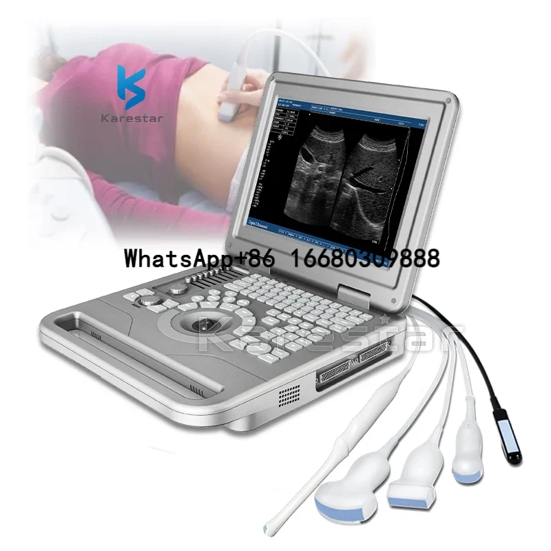 

Digital High Resolution Portable Ultrasound Medical Doppler Scan Machine Medical Device Ultrasound Price