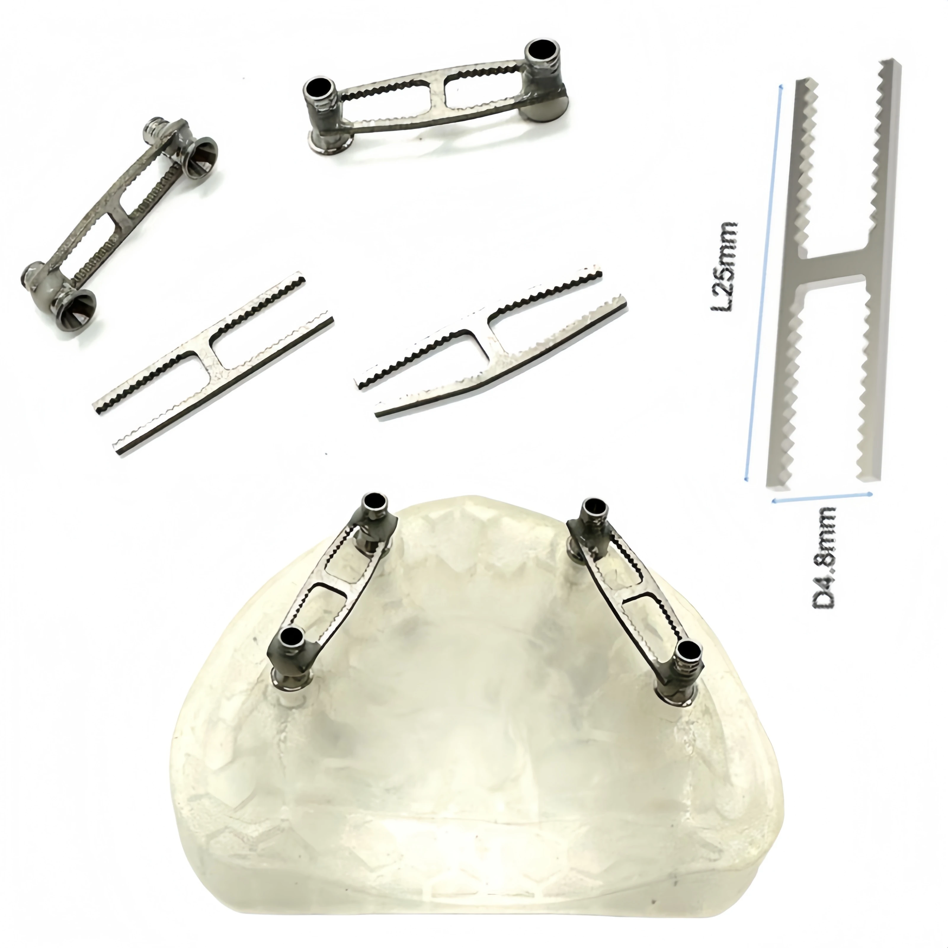 10 Pcs Dental Implant Impression Reinforcing Bar Dental Lab Fits Straumann& Nobel Temp Bridge & Multi-Implant Analog Connection
