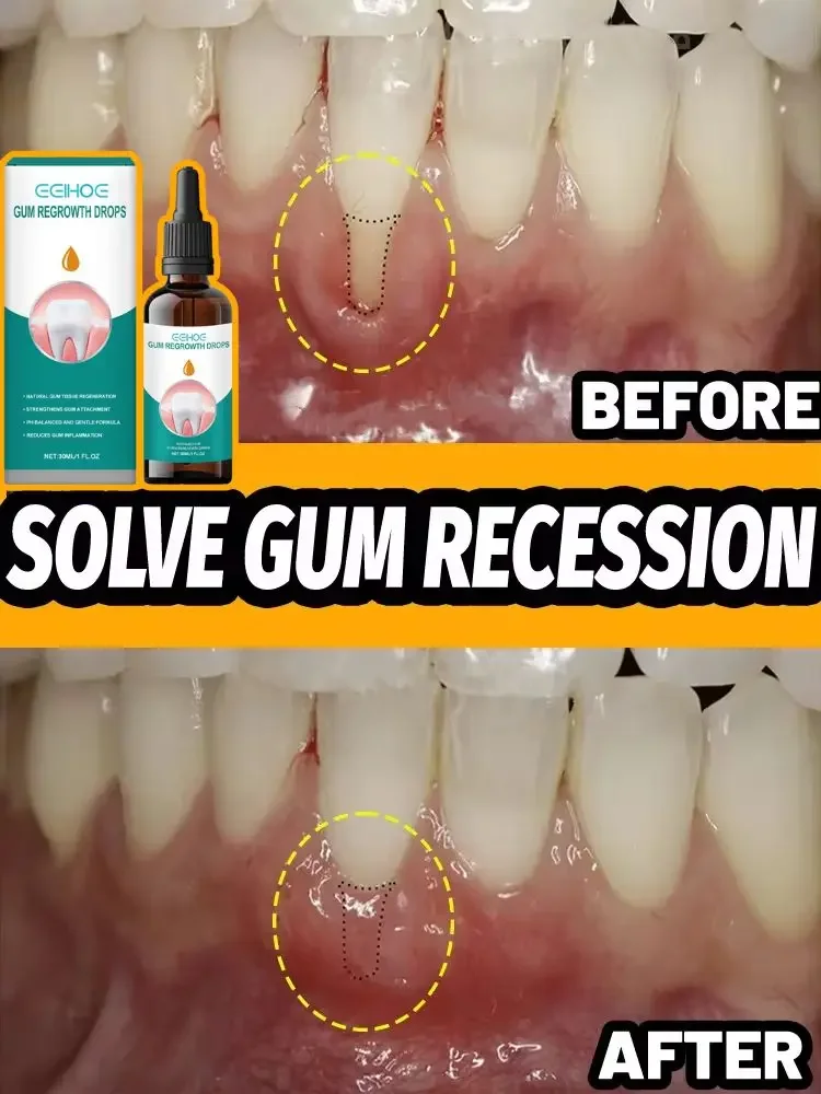 Rapid Repair Gums Serum Effectively Relieve Tooth Allergy Dental Caries Regrowth Drops, Gums For Receding Gums Toothpaste