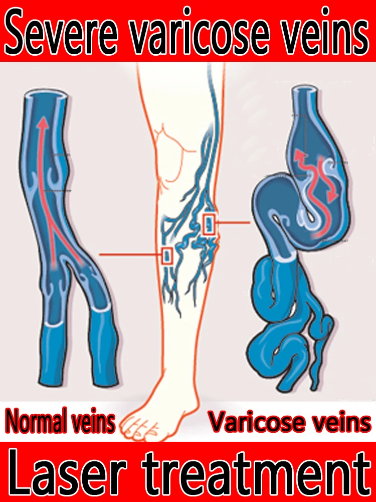 

Лазерная обработка второго поколения для серьезных aziazi אור